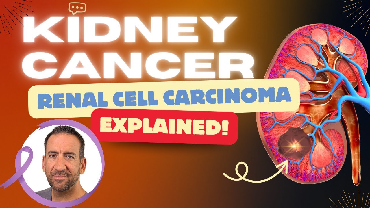 Kidney Cancer / Renal Cell Carcinoma: EXPLAINED