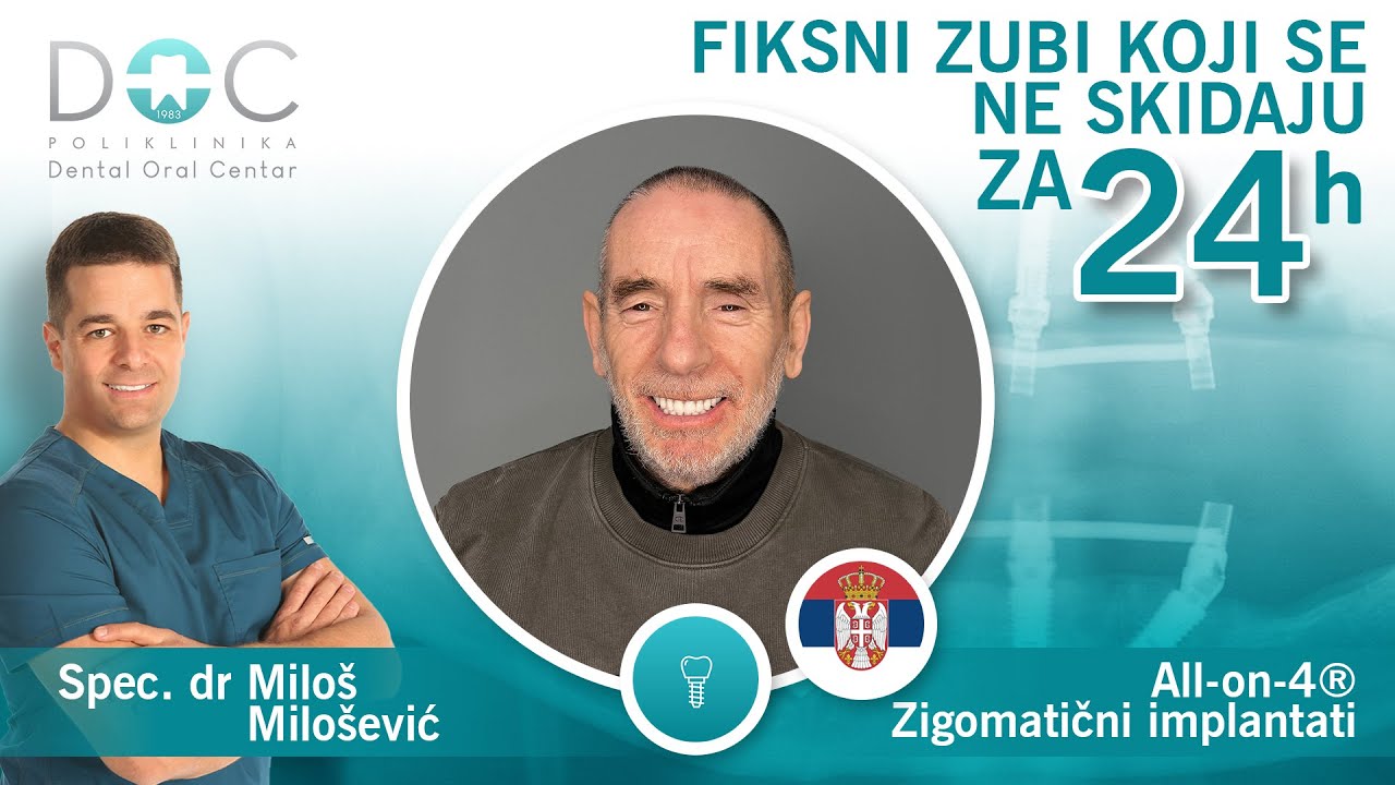 Novi zubi za 24h - Lepi Mića - Iskustvo pacijenta