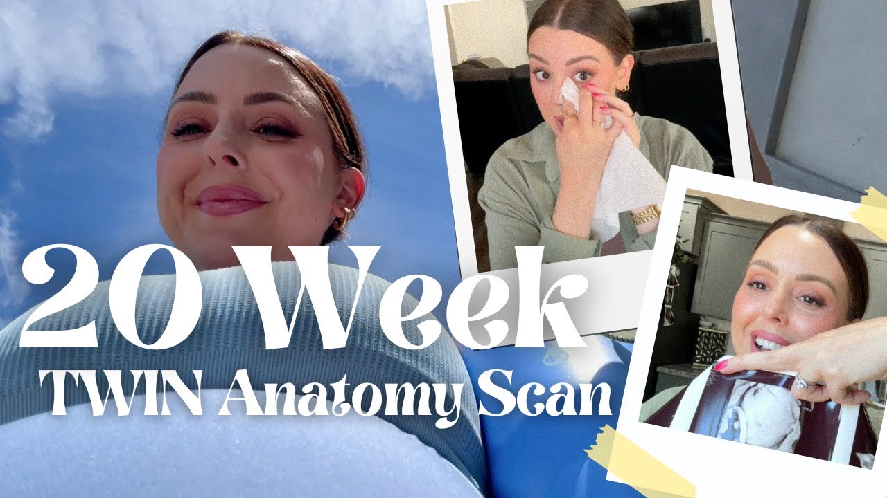 20 Week TWIN Anatomy Scan VLOG | Easy Smoothie, Pilates, Feeling So GRATEFUL 🥹