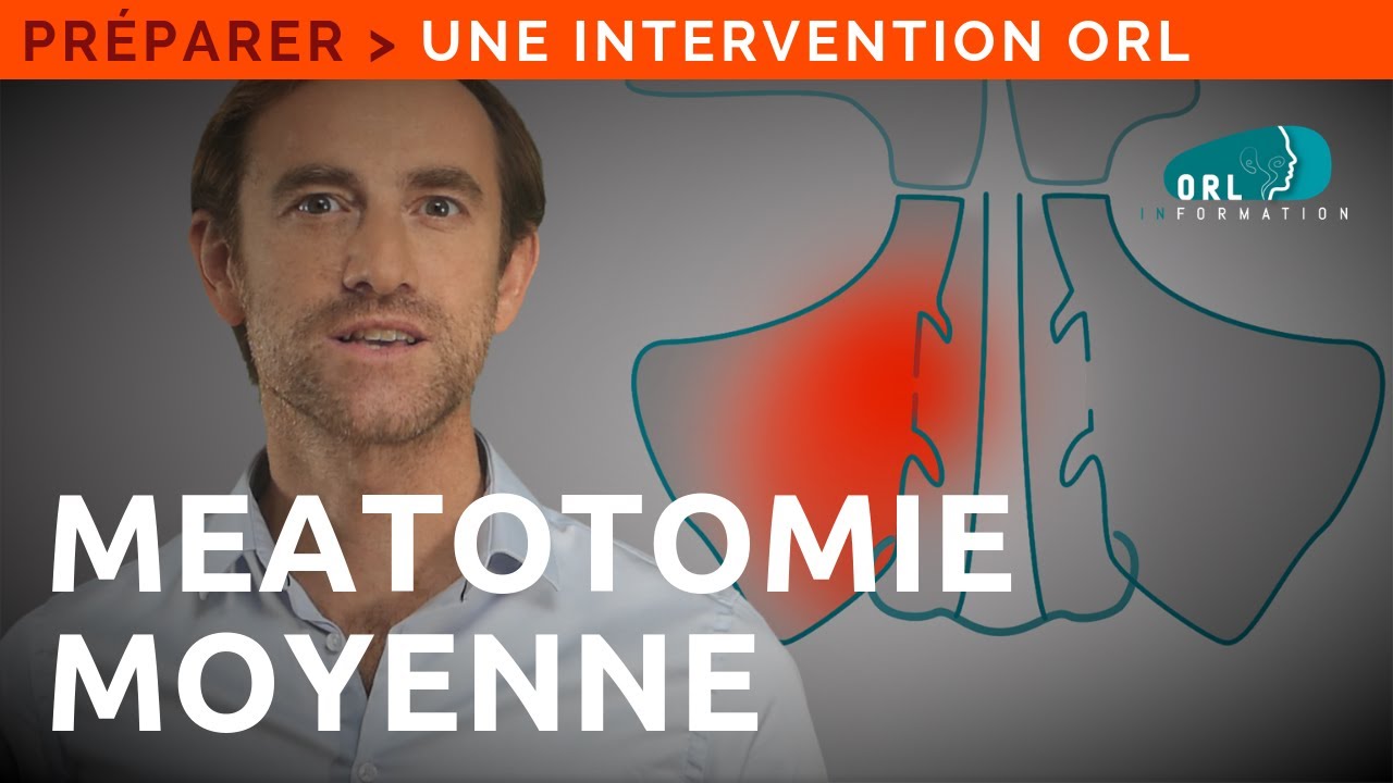 Information Patient | Chirurgie du nez (ouverture des sinus maxillaires)