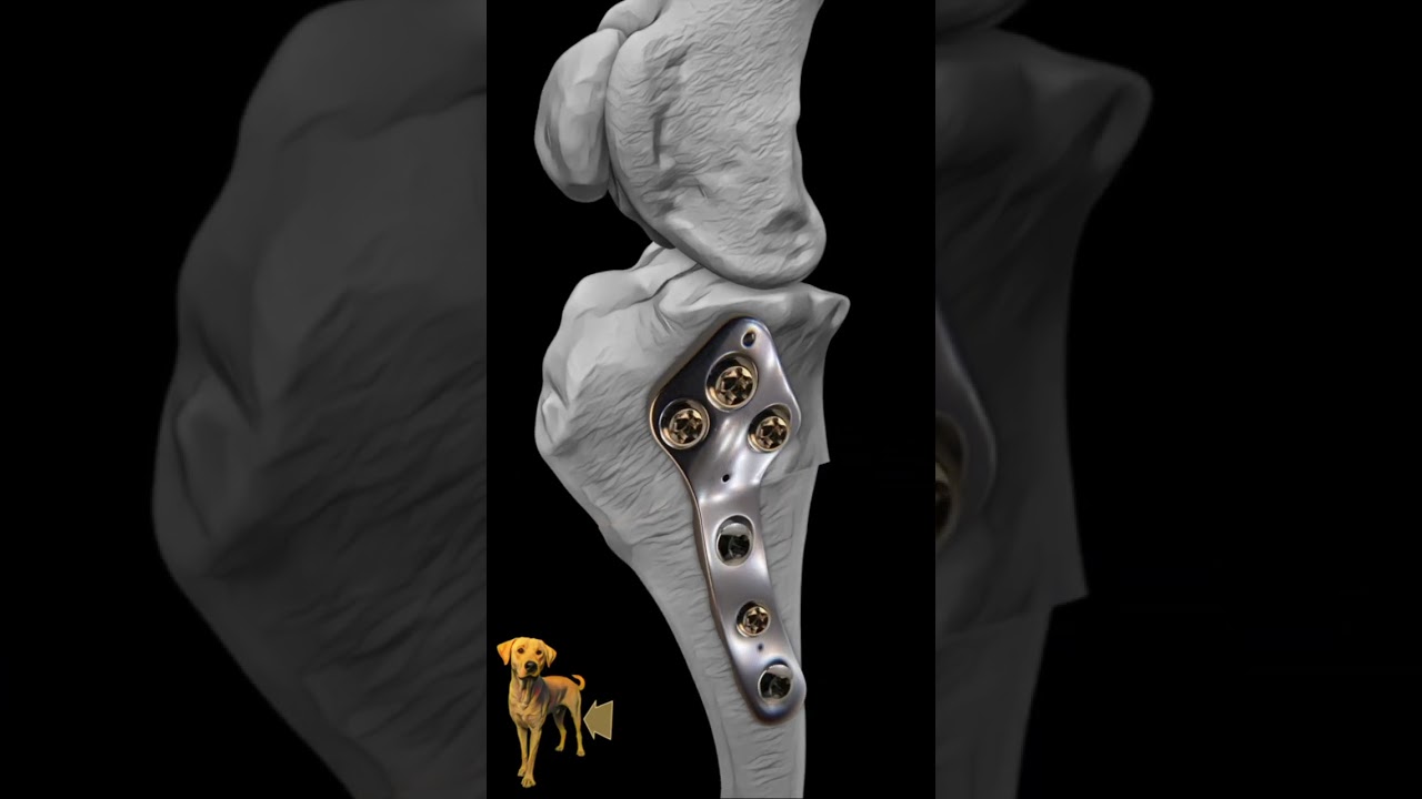 What is a closing wedge TPLO?