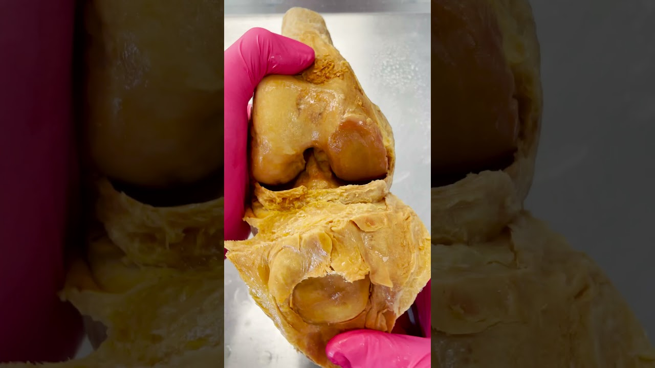 Incredible View of a Knee