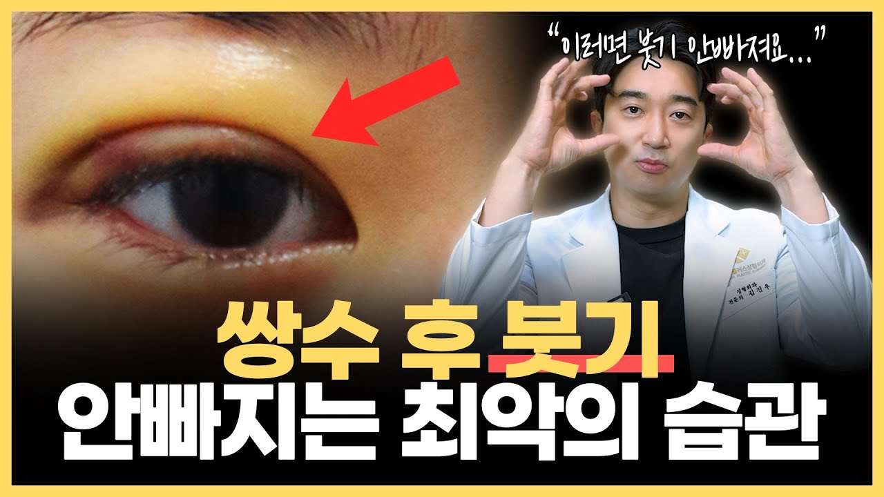 전문의가 알려주는 “쌍수 후 붓기 빨리 빼는 법”  쌍꺼풀 자연스럽게 자리잡고 싶다면 이렇게만 하세요