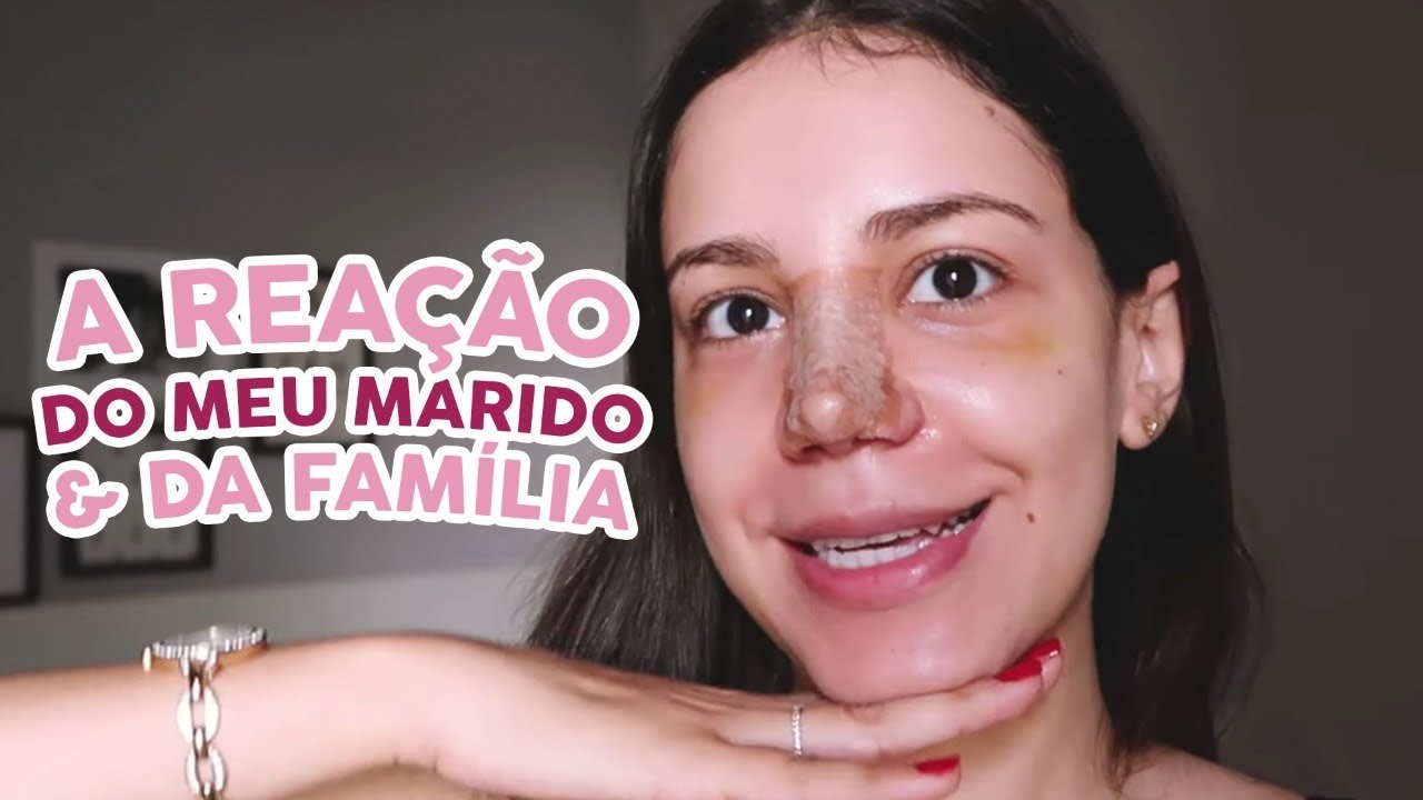TIREI O CURATIVO DO NARIZ NA VÉSPERA DE NATAL