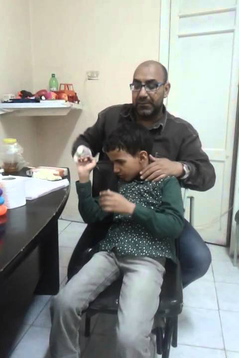 علاج زيادة اللعاب