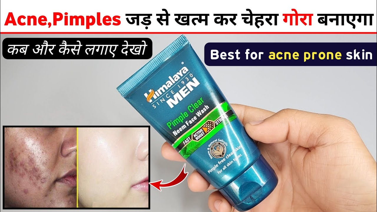 Himalaya Men Pimple Clear Neem Face Wash Review | himalaya neem face wash | himalaya face wash