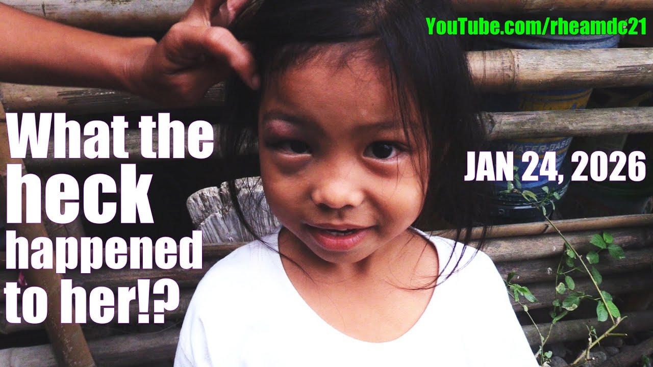 What the Heck Happened to Her Eye? Giving Joy to Filipino Families Since 2006. Help in Philippines!