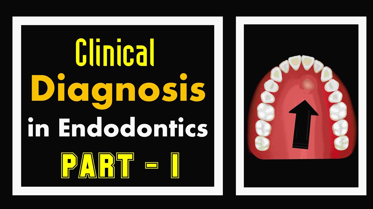 Diagnosis in ENDODONTICS | Part 1