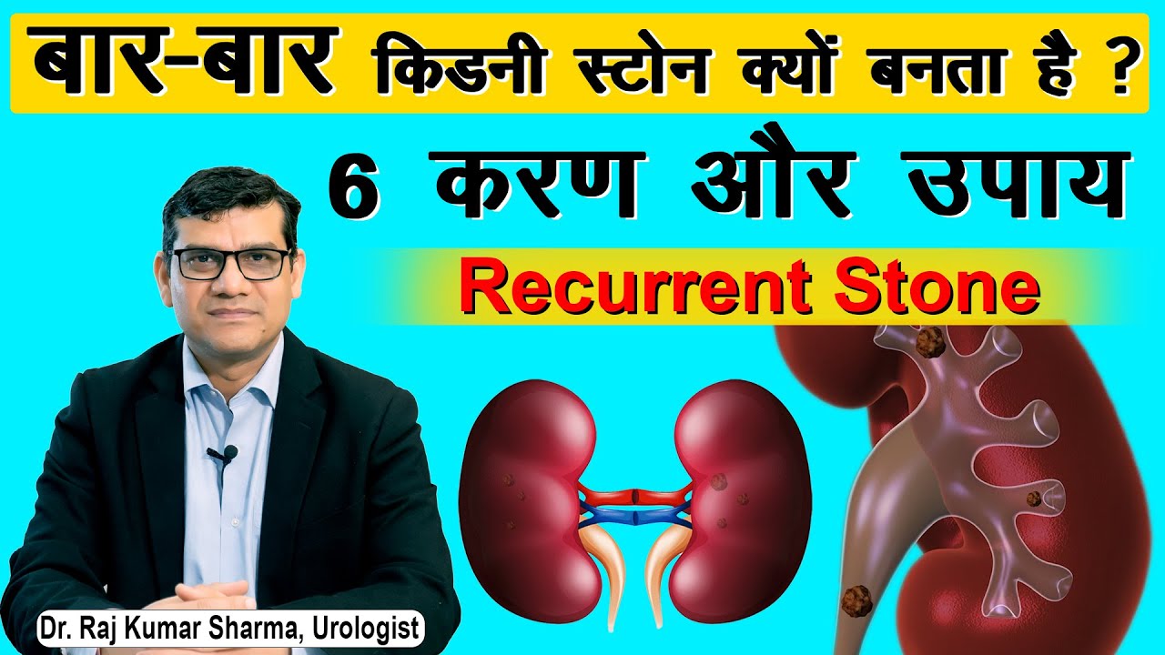 बार-बार किडनी स्टोन क्यों बनता है ? || Recurrent Stone || Dr. Raj Kumar Sharma - Urologist