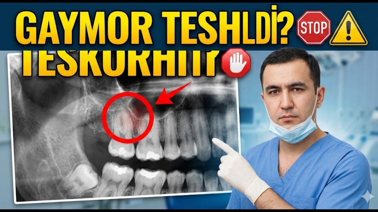 Tish olingandan keyin ovqat burundan chiqishiga sabab nima Arzon qimmat klinikalar farqi