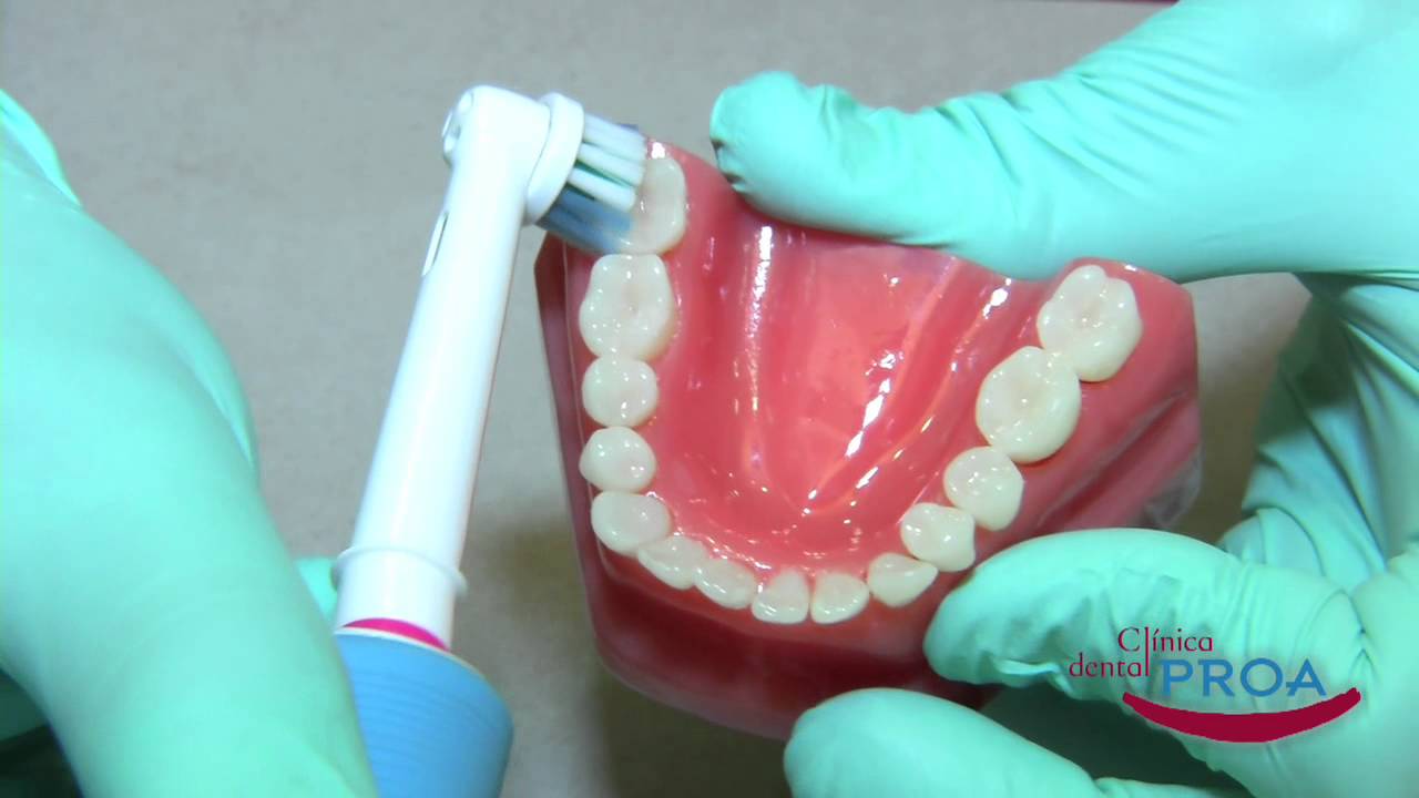 ¿Cómo cepillarse los dientes con un cepillo eléctrico?
