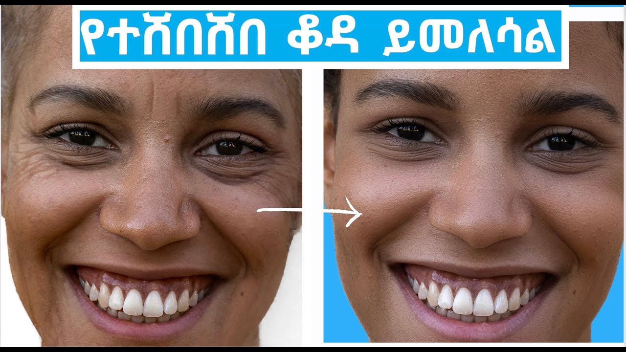 ለተሸበሸበ ቆዳ በሳይንስ የተረጋገጡ መፍትሔዎች/How to Boost your collagen  effectively.