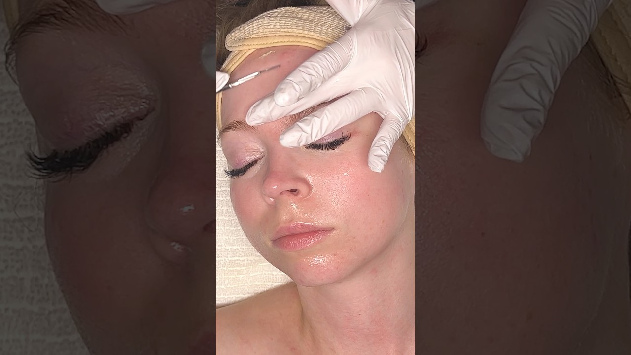 ASMR Dermaplaning on ​⁠@KayAndTay