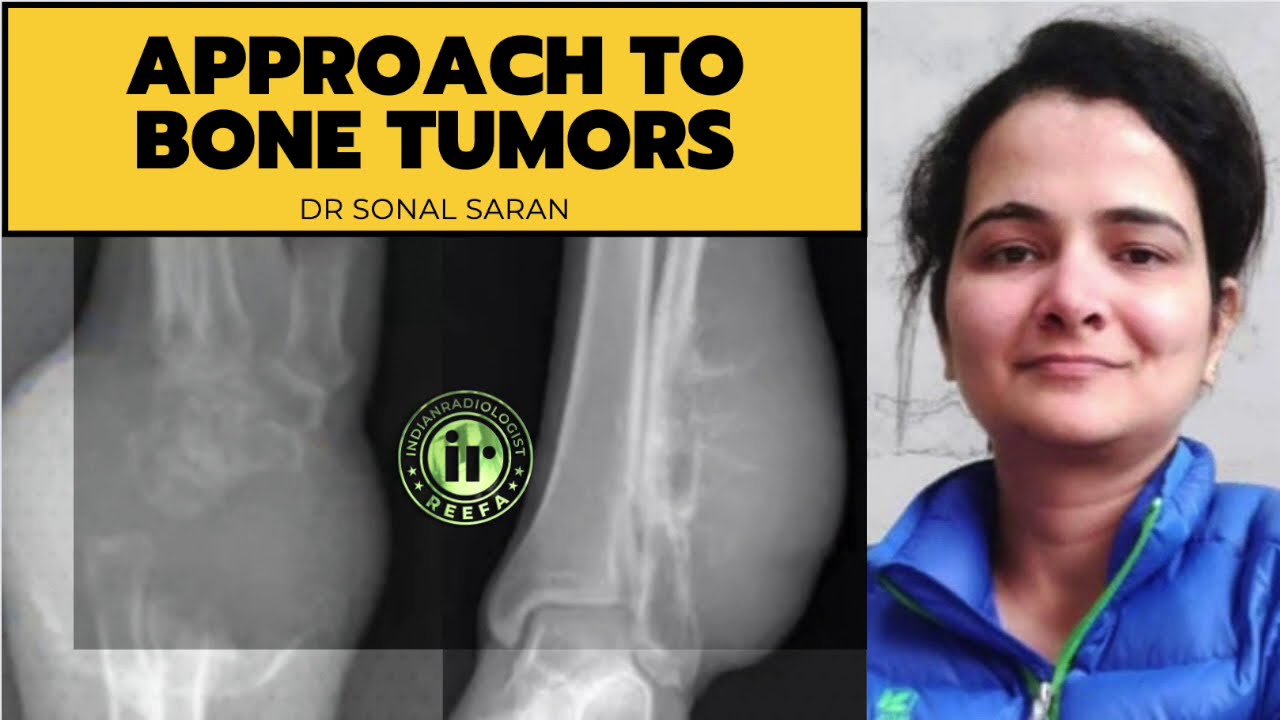 INTRODUCTION TO BONE TUMORS | DR SONAL SARAN | AIIMS RISHIKESH | PERIOSTEAL REACTION |