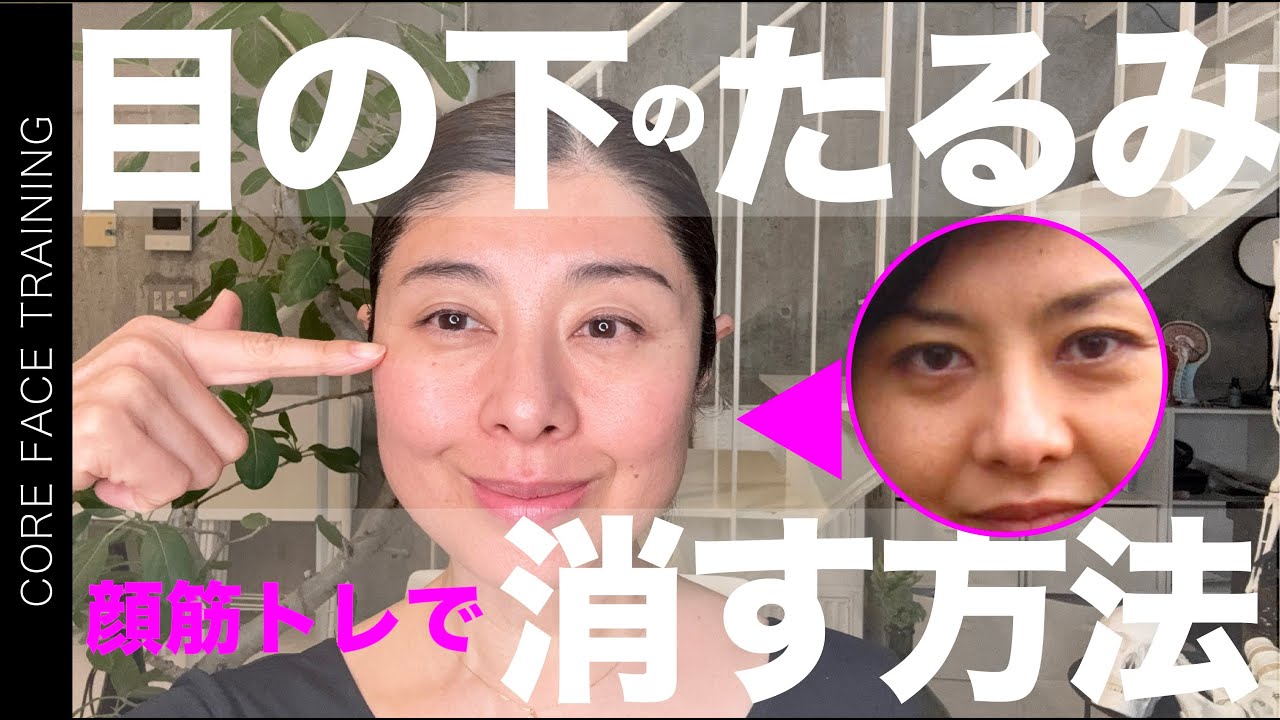 【目の下のたるみ 消す方法】Q.目の下のたるみが気になります。自分でケアする方法が知りたいです【顔のお悩み相談室】