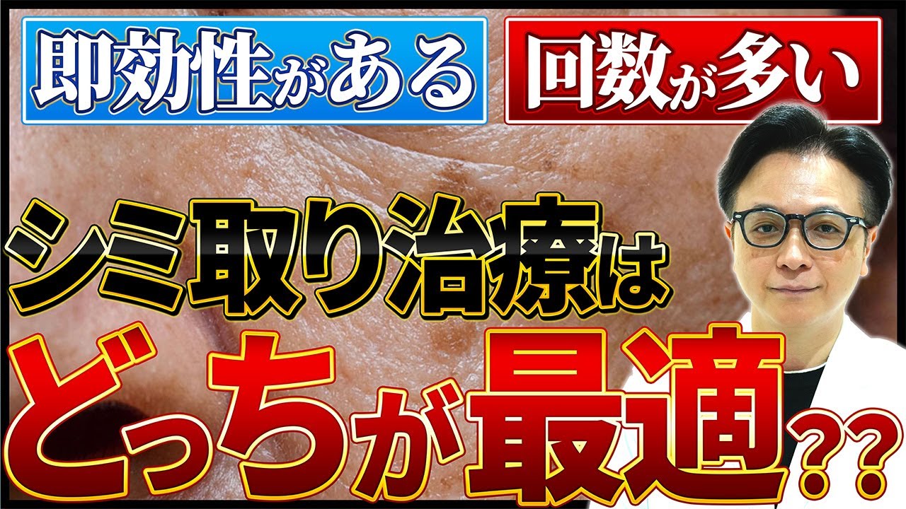 その選択で大丈夫ですか...???本当に効果のあるシミ取り治療を日本トップレベルの美容皮膚科医が徹底解説します