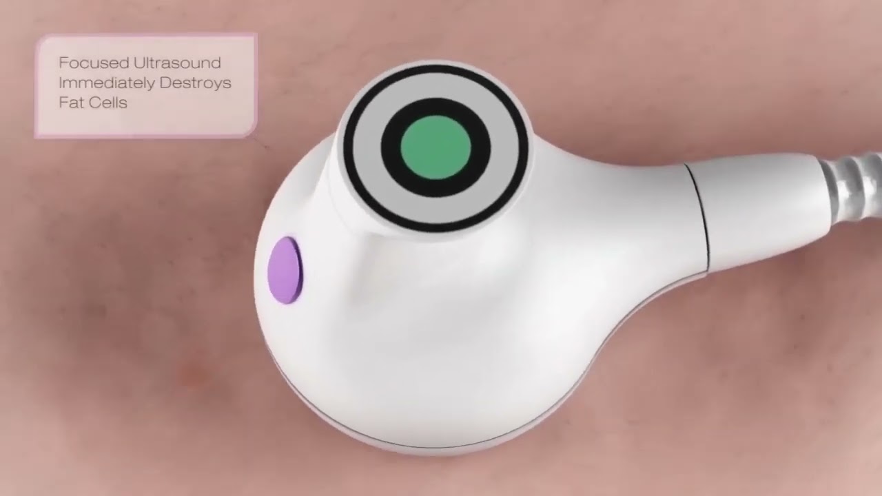 UltraShape Treatment Clip