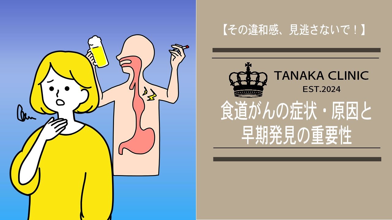 33　食道がんの症状・原因と早期発見の重要性｜【胃腸と内視鏡の専門チャンネル】たなか内科クリニック
