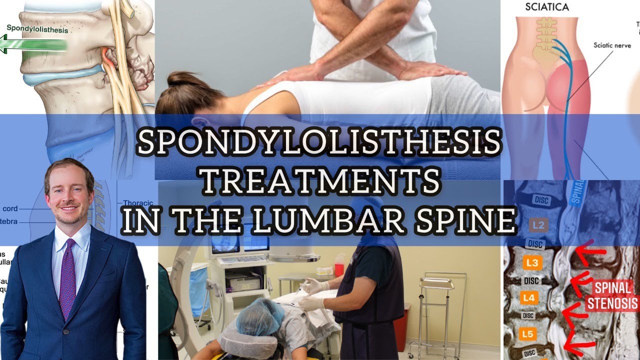 Spondylolisthesis Treatment Options in the Spine