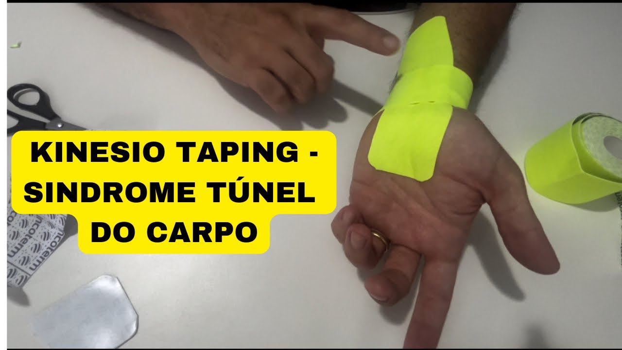 COMO APLICAR A FITA NO PONTO CERTO - SÍNDROME TÚNEL DO CARPO