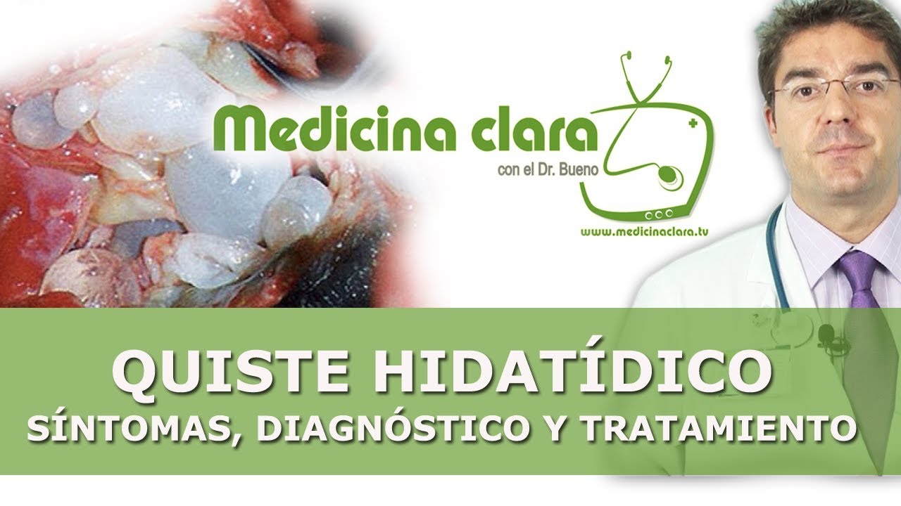 Quistes hidatídicos | Quistes en hígado | Quistes en pulmón | Hidatidosis