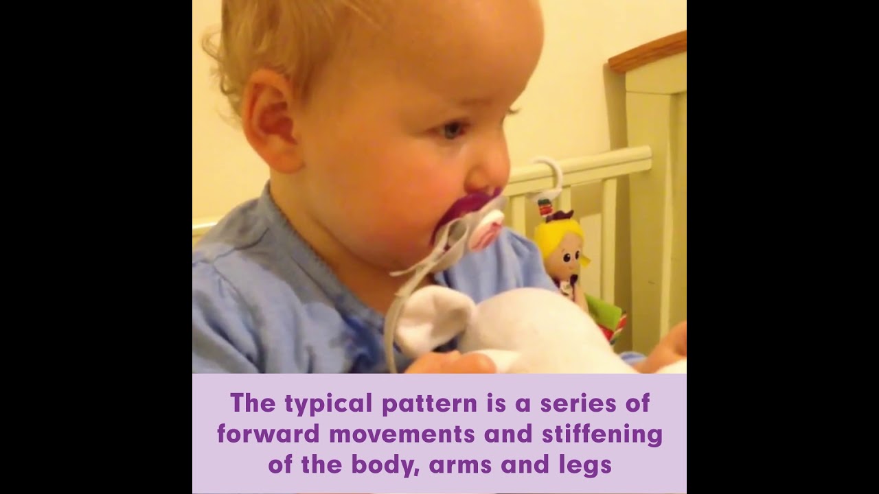 Infantile Spasms: What Every Parent Needs To Know