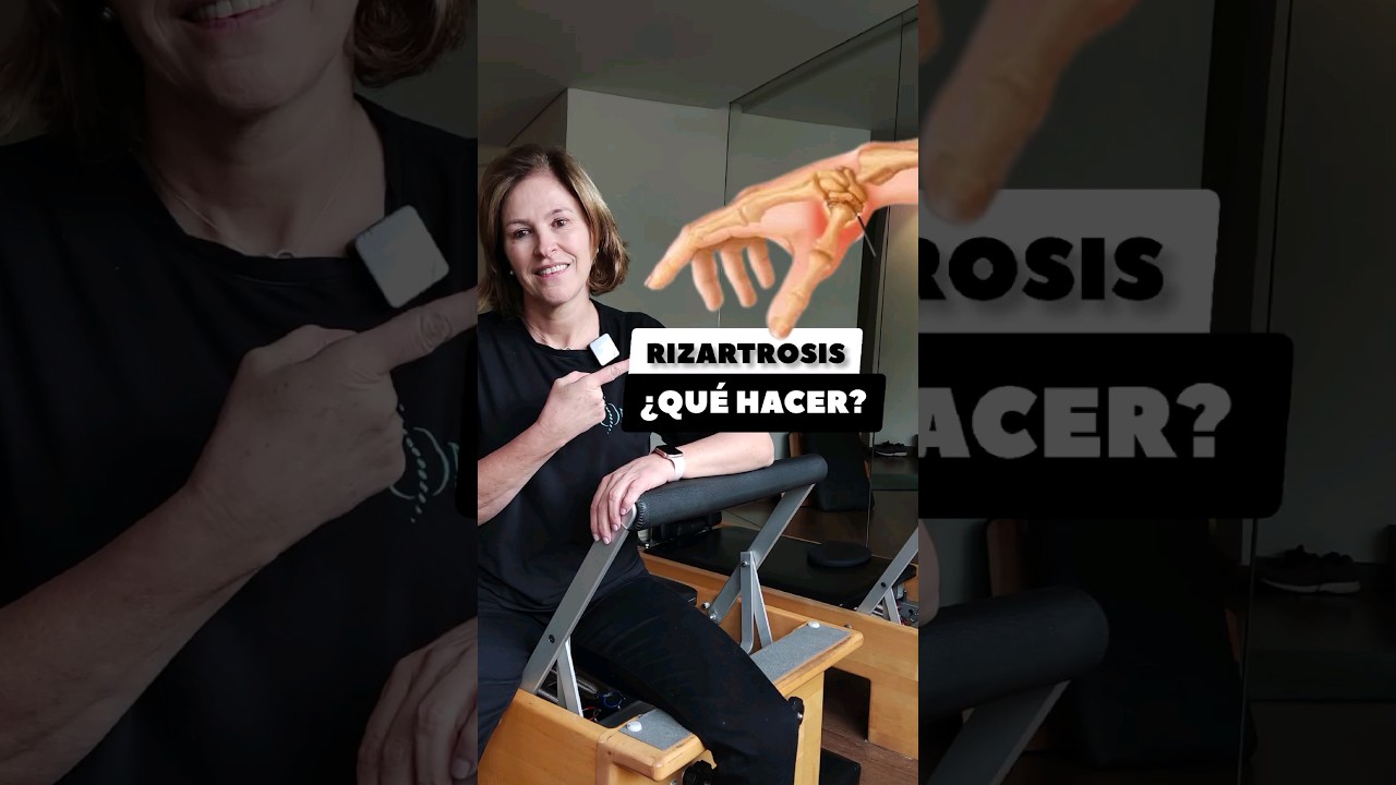 RIZARTROSIS &iquest;QU&Eacute; HACER?