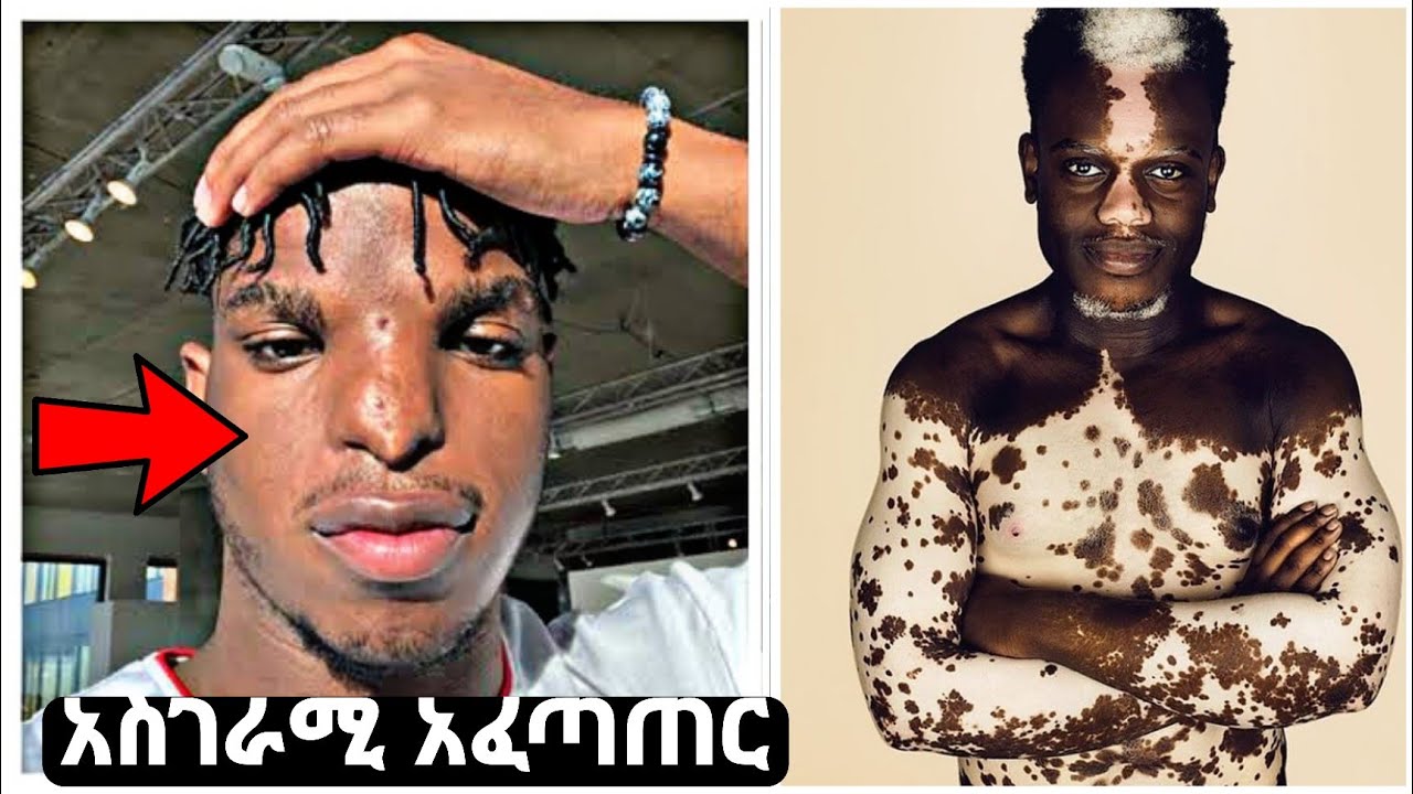 10 አስገራሚ አፈጣጠር ያላቸው እና የተገፉ ሰዎች