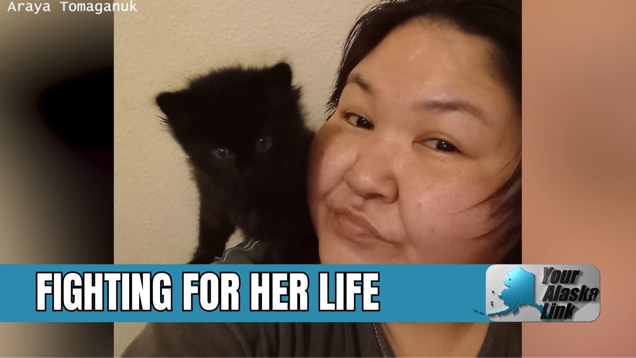 Mother fights for life after mobile home fire in Anchorage