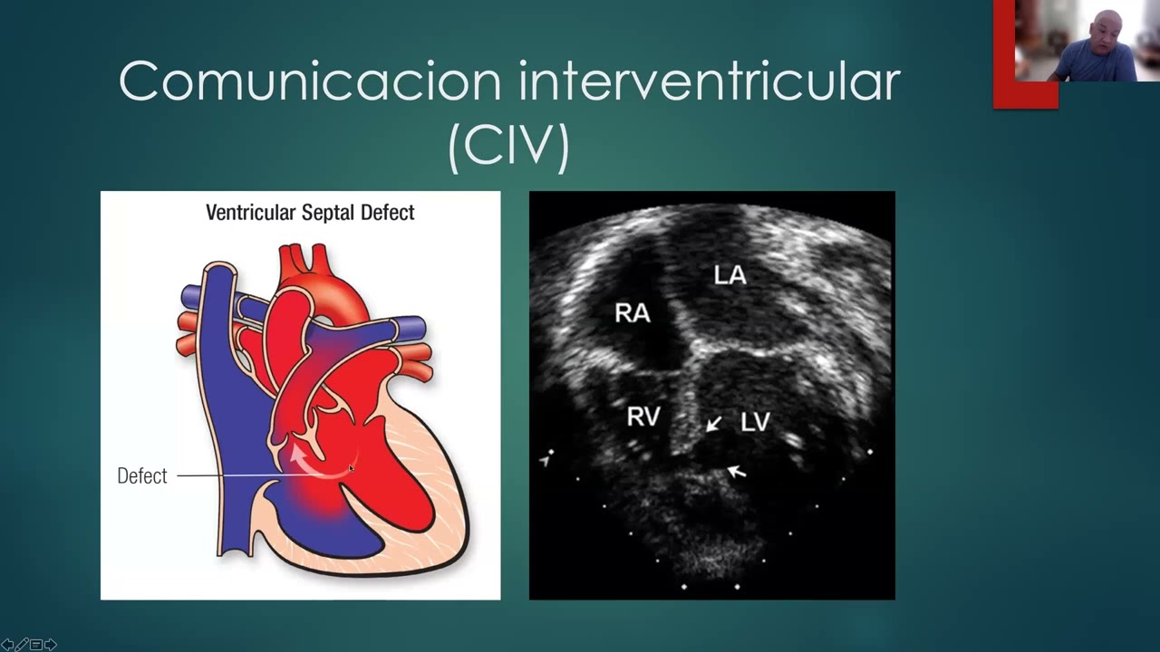 Tema del seminario web Cardiopatías congénitas en Pediatría