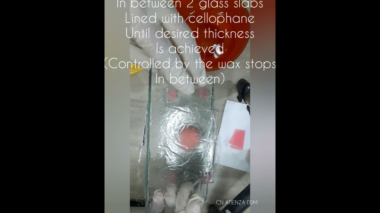 Fabrication of Trial Denture Bases