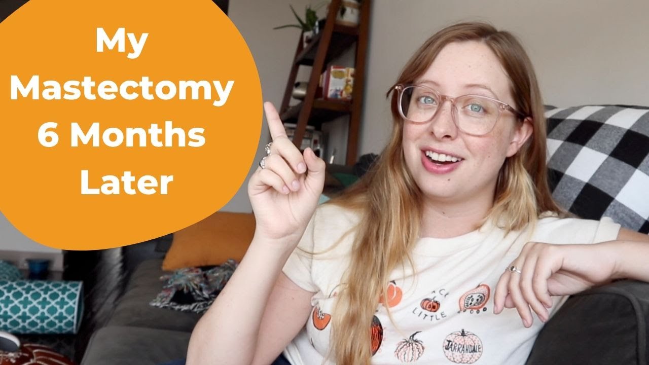 My Mastectomy Surgery Recovery 6 Months Later (Direct to Implant, Nipple Sparing) - What to expect.