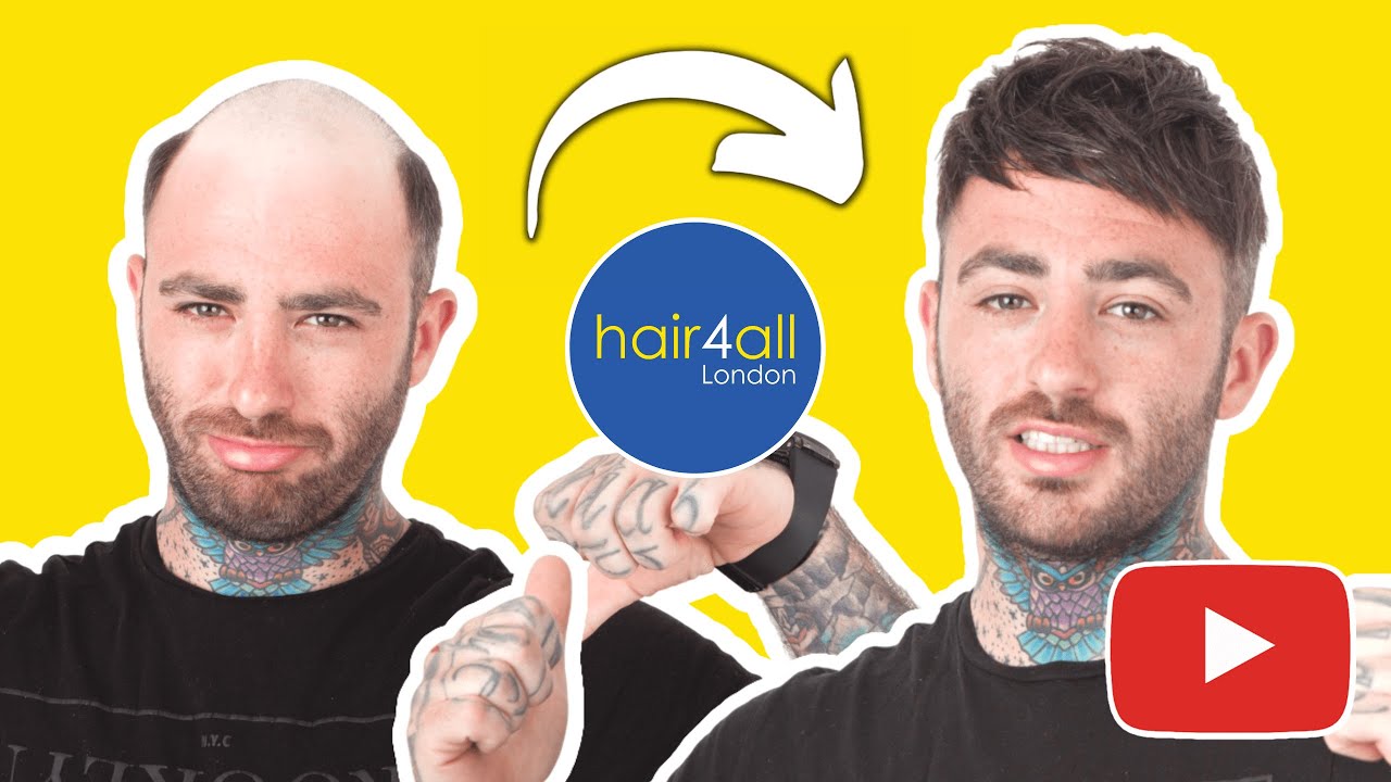 Before & After | Hair System | Fitting | Non-Surgical Hair Replacement System for Men/Women