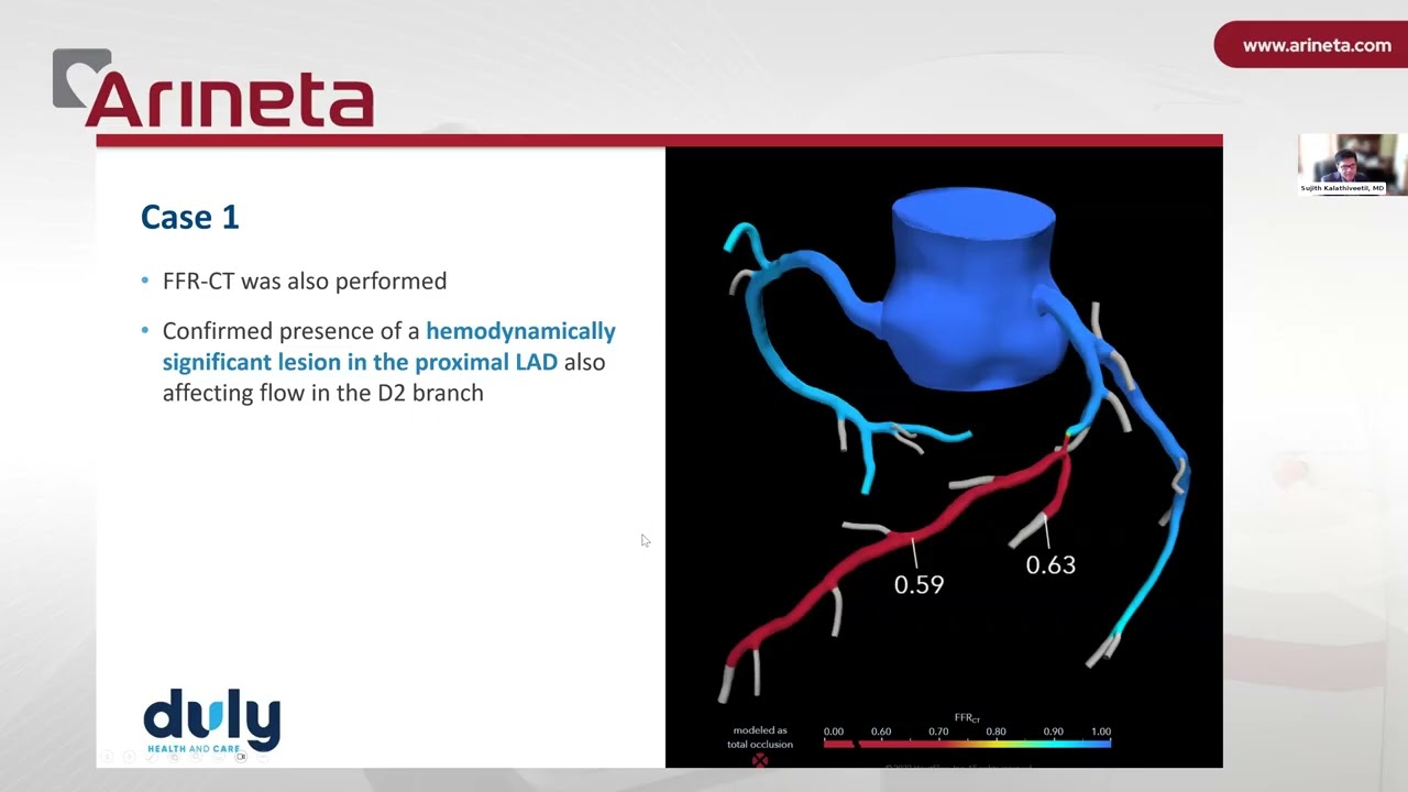 Sponsored webinar | CT-first imaging: Rethinking chest pain evaluation and atherosclerosis detection