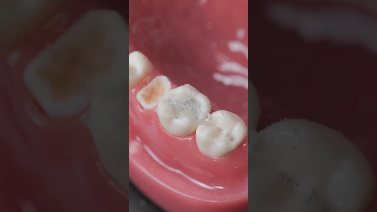 You Won&rsquo;t Believe How Easy It Is to Fix Your Teeth! 😲🦷 But Why Is It Always So Expensive?