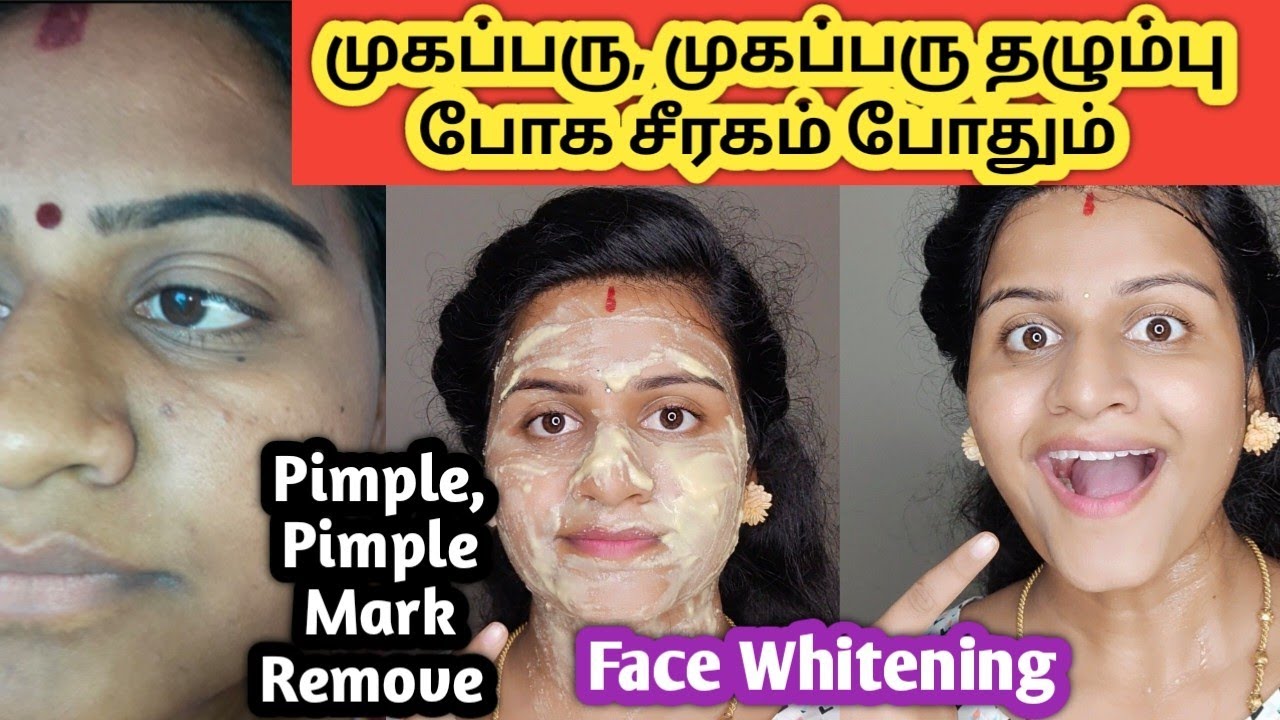Pimple, Pimple Mark Remove face pack/Skin Whitening Pack/முகப்பரு போக/jasvika media