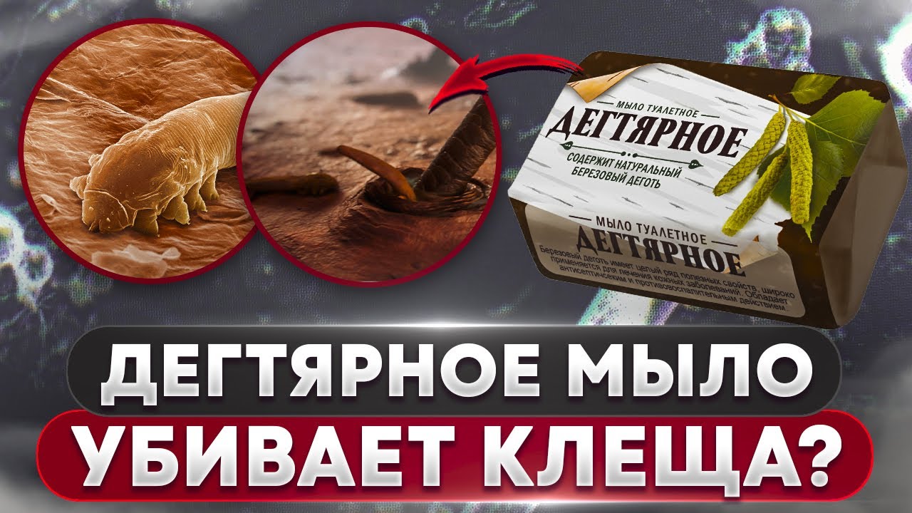 🧼 Дегтярное мыло против клеща | Угревая Железница Demodex