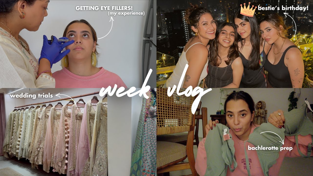 FIRST TIME GETTING FILLERS! (& more!) | vlog
