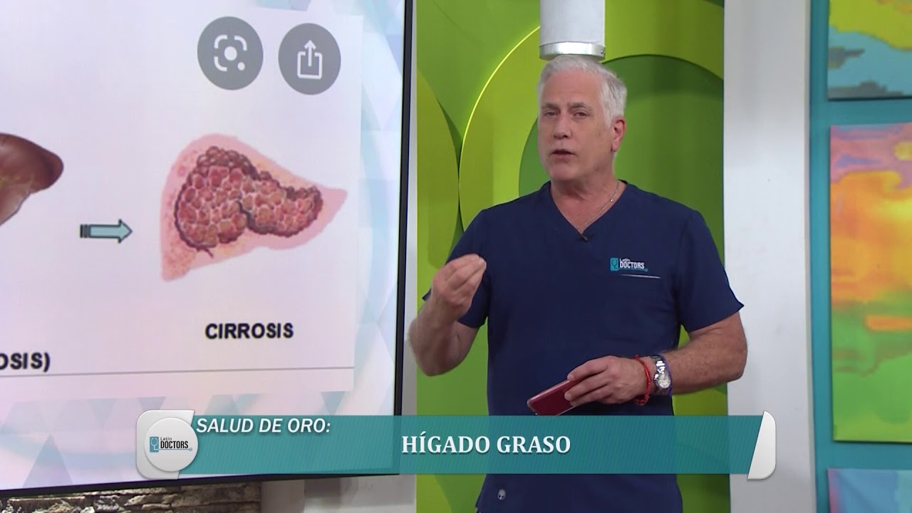 Tratamientos H&iacute;gado Graso - Latin Doctors
