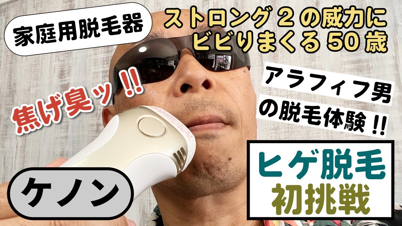 ケノンでヒゲ脱毛に初挑戦｜ストロング２のレベル２で照射したら焦げ臭くなった！