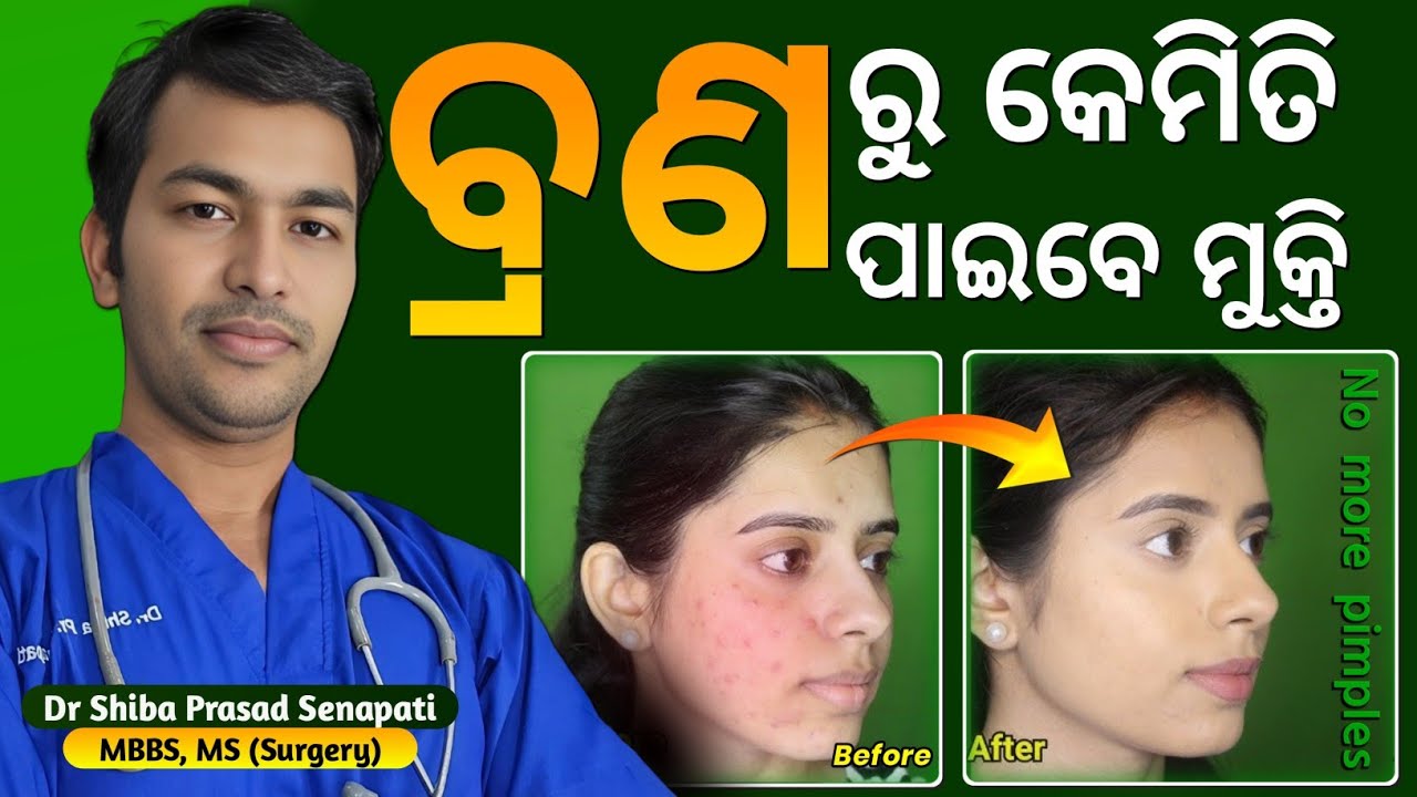 ବ୍ରଣରୁ କେମିତି ପାଇବେ ମୁକ୍ତି#odiahealthtips#acne
