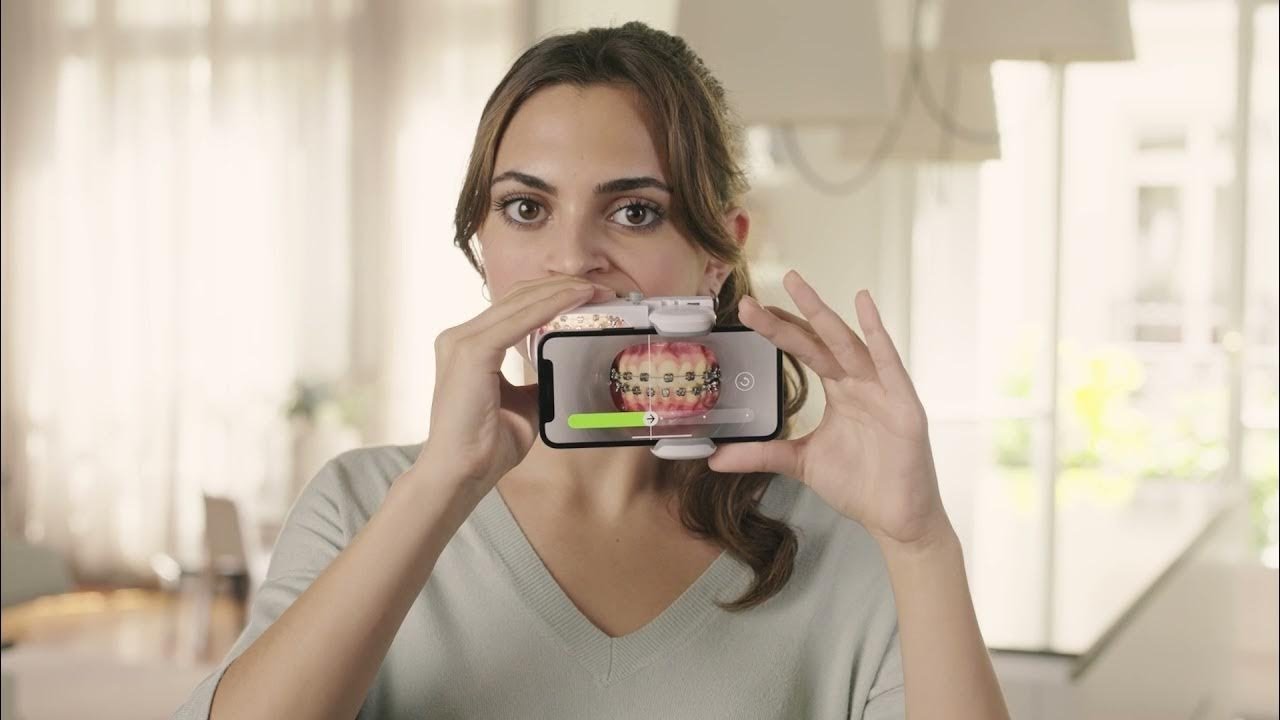 How to use ScanBox Pro with braces - A Patient's Guide
