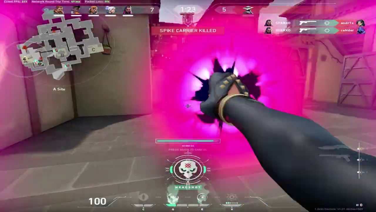 starxo valorant highlights #2