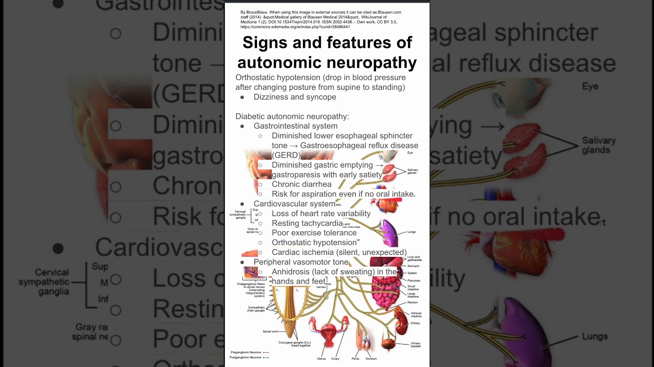 Signs and features of autonomic neuropathy