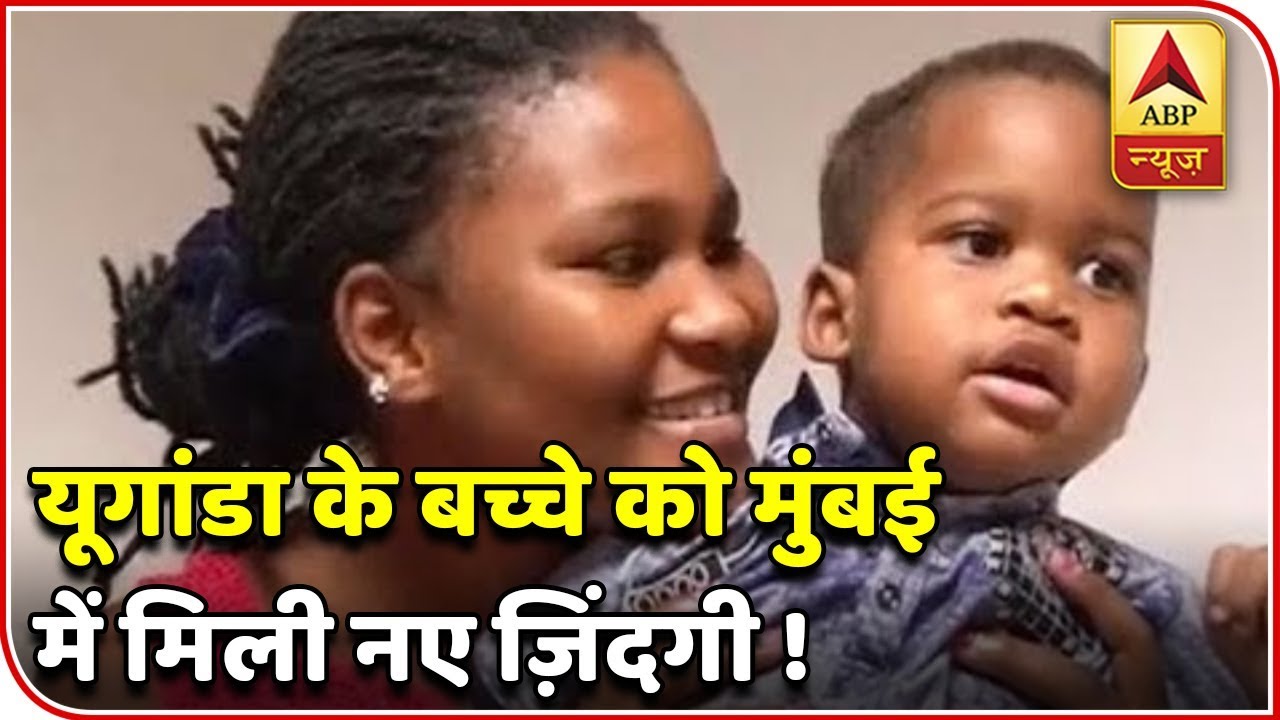 Mumbai Doctors Cure Uganda Child Suffering From Sturge Weber Syndrome | ABP News