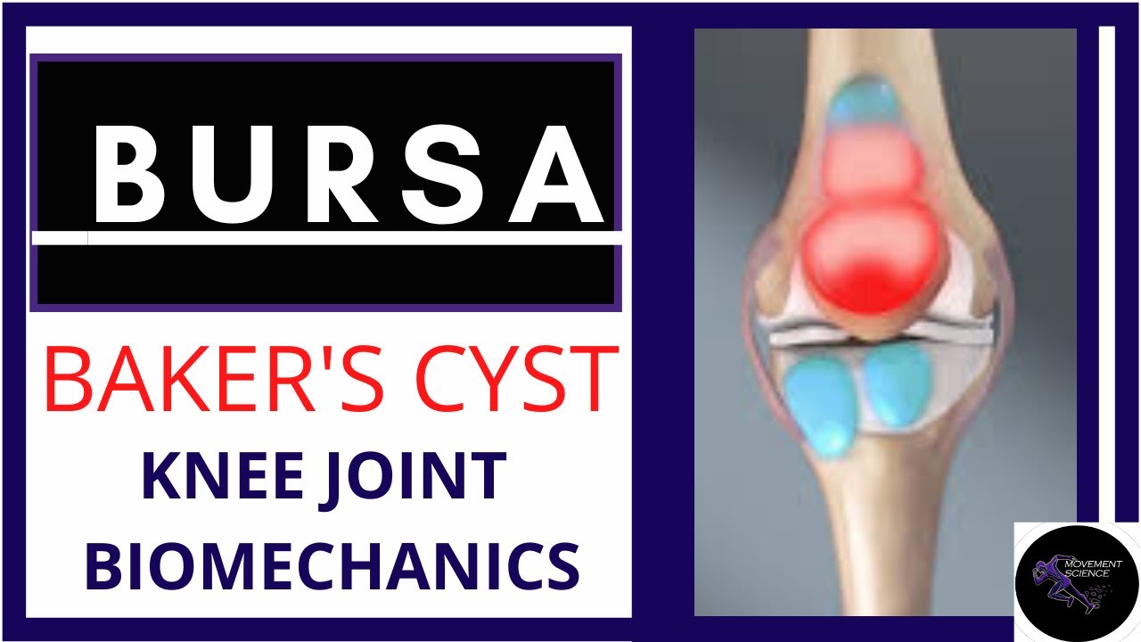 BURSA AROUND THE KNEE JOINT,BAKER'S CYST(KNEE JOINT BIOMECHANICS)PHYSIOTHERAPY TUTORIALS