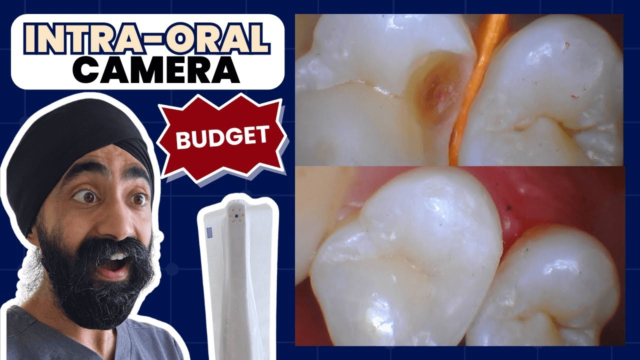 Budget Intra-Oral Camera Review: Surprisingly Good! FocusDent MD740