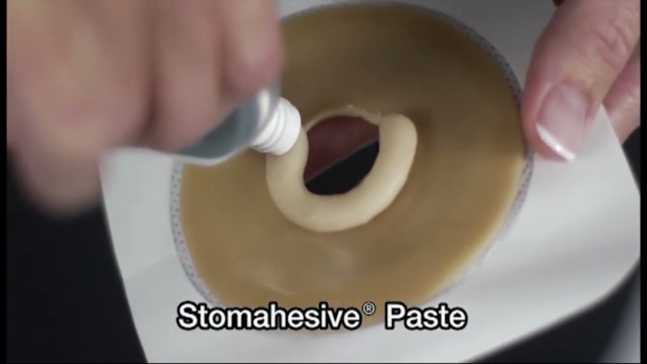 Pasta Tubo Stomahesive para Ostomia Convatec - Compre na Vitae Saúde