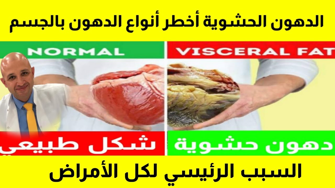 ٤٤٥) السبب الذي لا تعرفه لكل الأمراض الخطيرة | ما هو الفرق بين الدهون الحشوية و دهون البطن؟
