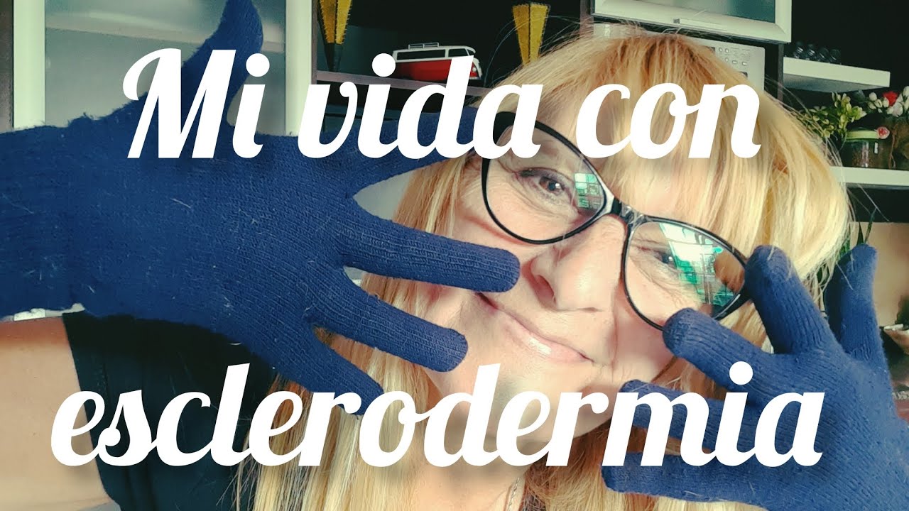 Mi vida con esclerodermia 💗 mis síntomas, diagnóstico y primera reacción 💗